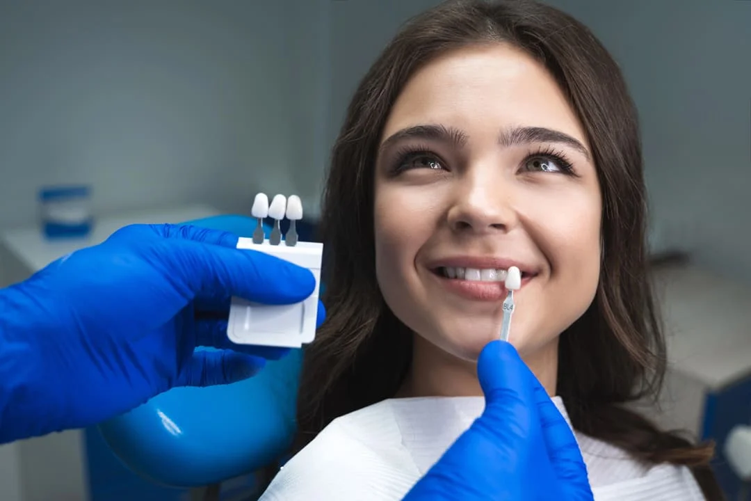 dental-veneer Dentist Bella Vista